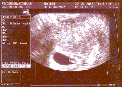 6wkus.gif