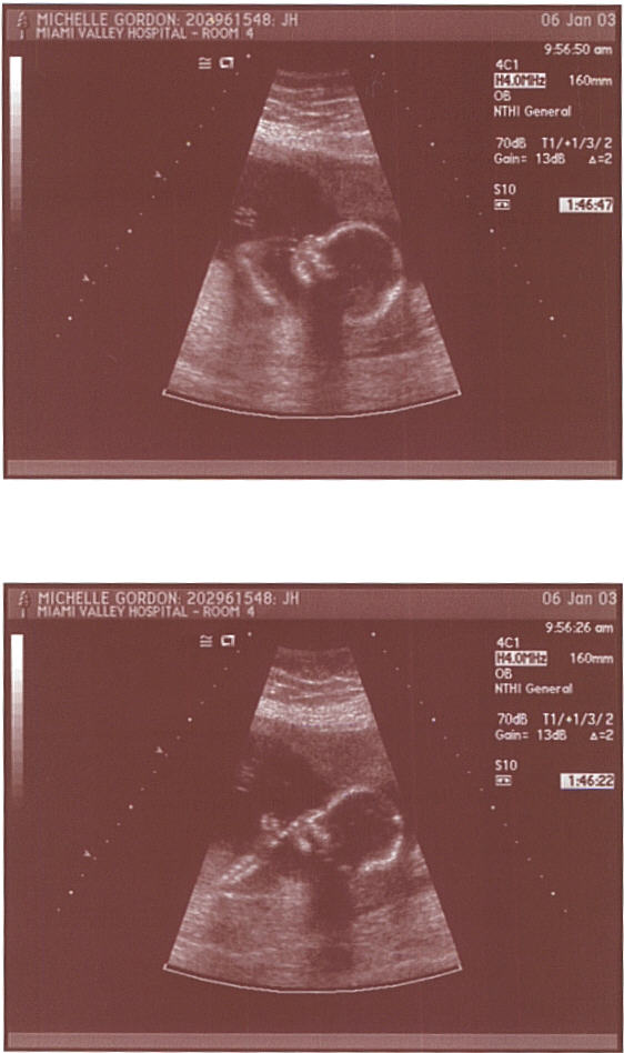 us18wk.jpg
